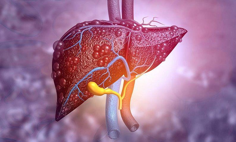 La hepatitis aguda de origen desconocido ya supera los 190 casos en el mundo