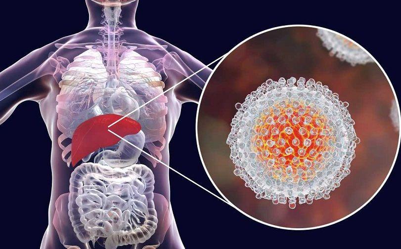 Salud confirmó el primer caso de hepatitis aguda grave de origen desconocido en el país