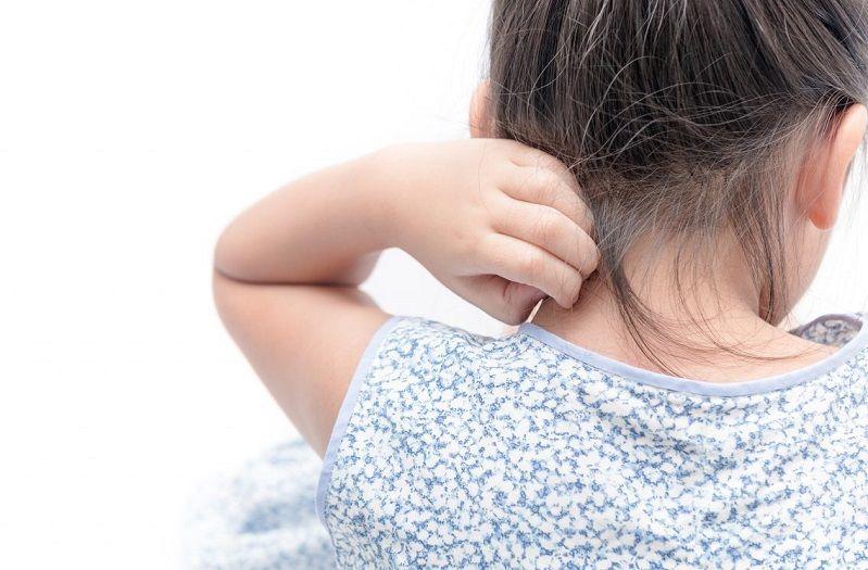 Se aprobó nuevo medicamento para la dermatitis atópica en niños