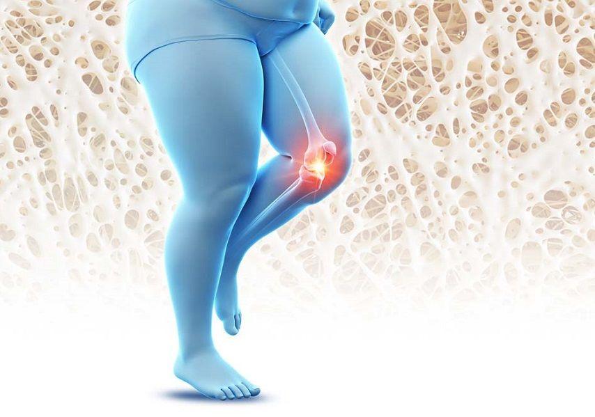 La obesidad aumenta el riesgo de fracturas óseas en mujeres