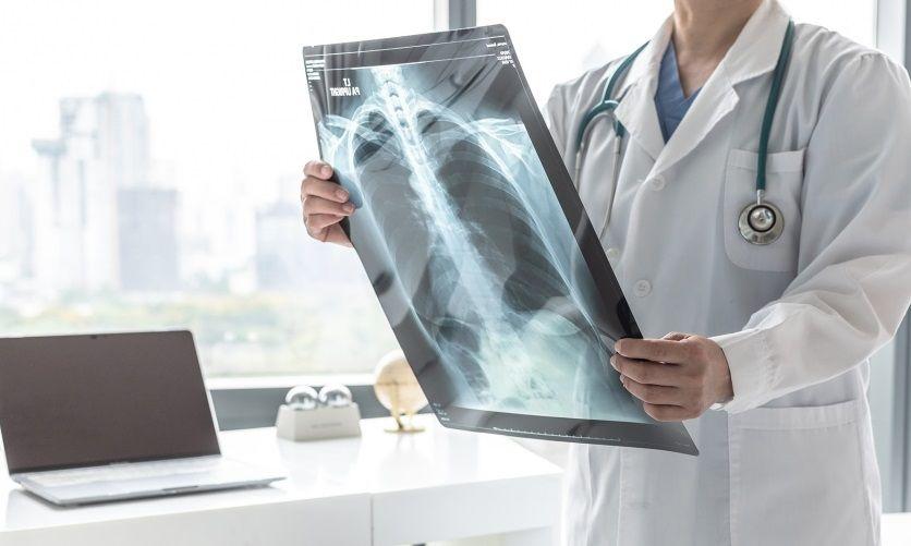 Las diferencias en las vías respiratorias de las mujeres aumentan el riesgo de EPOC