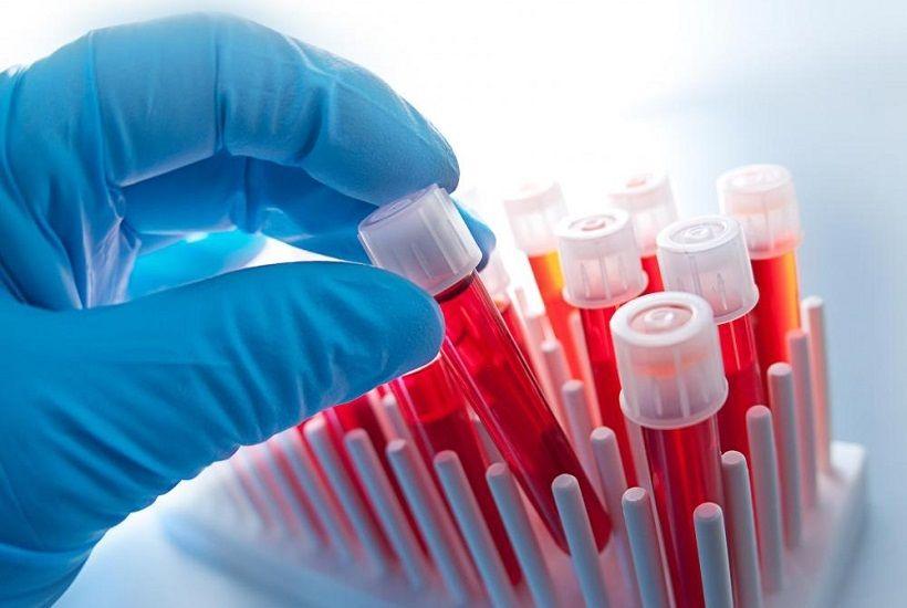 Análisis de sangre permitirán detectar precozmente hasta 50 tipos de cáncer
