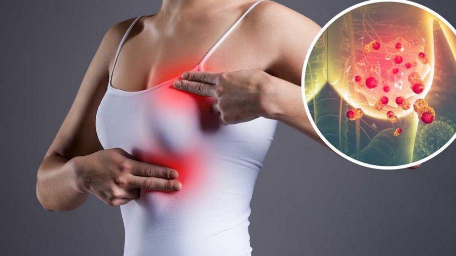 Cáncer de mama: ¨No alcanza con el autoexamen para detectarlo a tiempo¨