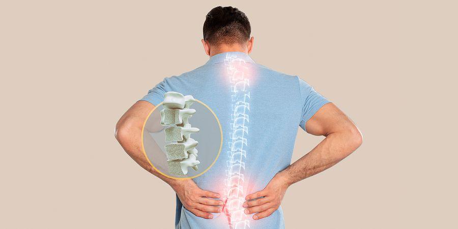 Osteoporosis: cómo prevenir la enfermedad que causa 90 fracturas de cadera por día