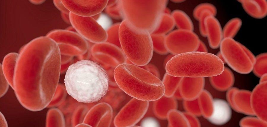 Síndromes Mielodisplásicos: ¿cómo reconocer y tratar esta enfermedad?