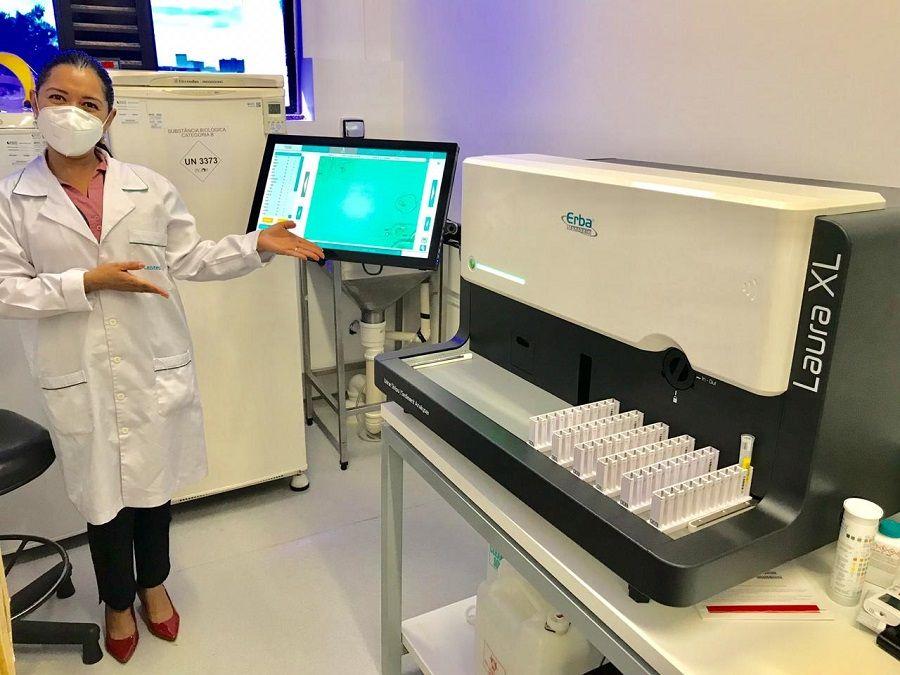 Llega al mercado argentino un equipo para optimizar el análisis de orina