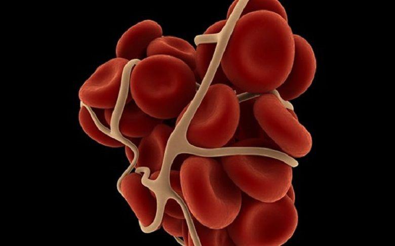 Mielofibrosis: una enfermedad silenciosa, veloz y que afecta cada vez a más jóvenes