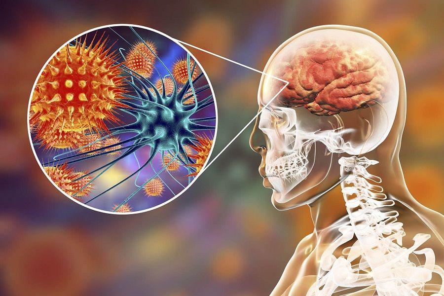 ¨La meningitis bacteriana tiene una alta tasa de mortalidad¨, afirmó la Dra. Florencia Cahn