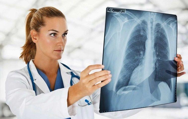 En Argentina se detectan unos diez mil casos de tuberculosis al año