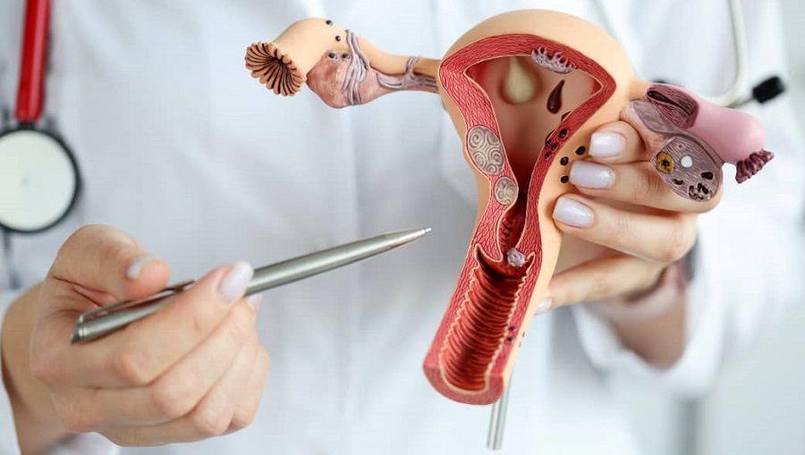¿Cómo prevenir el cáncer de cuello uterino?