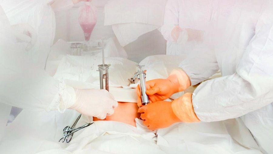 Trasplante de médula ósea: sólo el 25% de los pacientes tienen un familiar compatible