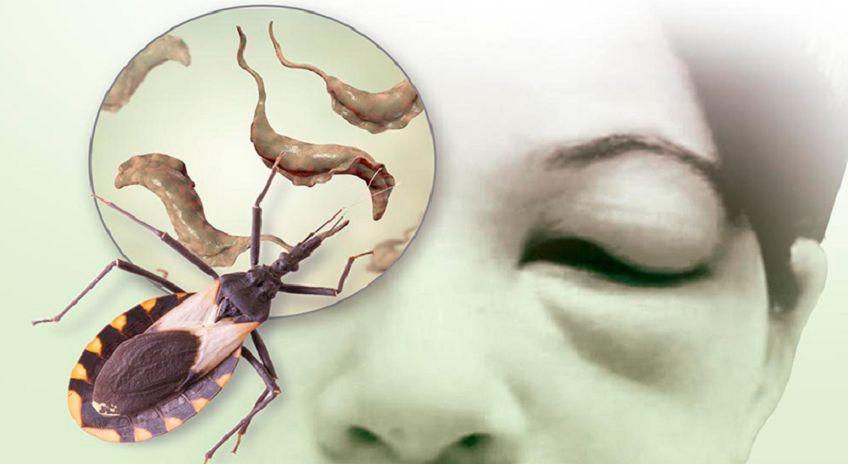 Menos del 10% de las personas con Chagas han sido diagnosticadas