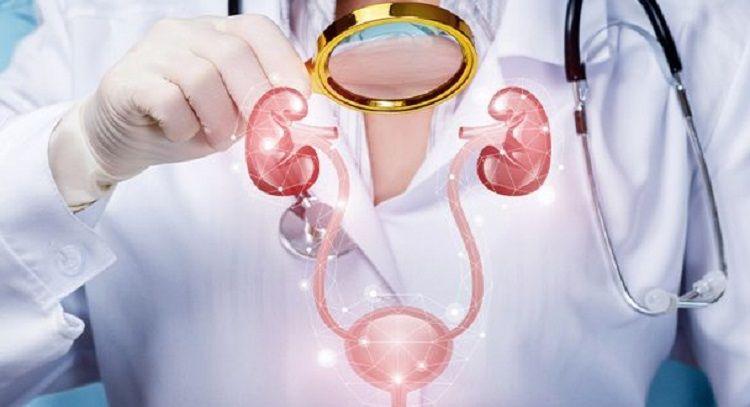 En Argentina 10 personas por día son diagnosticadas con cáncer de vejiga