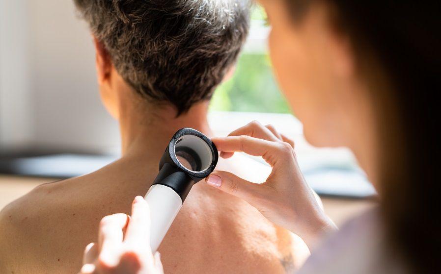 ¨MelaNOmás¨: decirle no más al melanoma, depende de vos