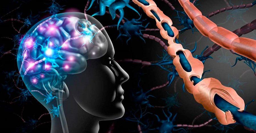 Esclerosis Múltiple: cómo la concientización contribuye a mejorar el pronóstico de los pacientes