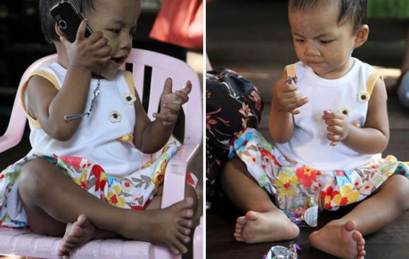 Niña de un año tiene 26 dedos