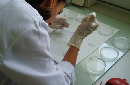 Una terapia con células madre muestra mejorías en pacientes con una forma agresiva de esclerosis múltiple  