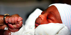 Insólito – Nace un niño con 24 dedos en Nueva York