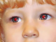 ¿Por que en algunas fotos aparecen las personas con los ojos rojos?