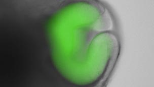 Crean retina artificial con células madre