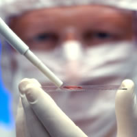 Medica Argentina diseña un dispositivo para medir la viscosidad de la sangre