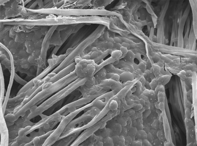 Investigadores Argentinos desarrollan textiles para repeler al dengue