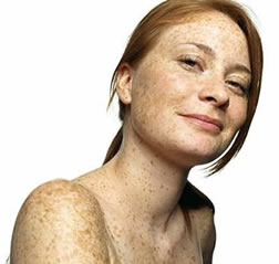 ¿Por que razón algunas personas tienen pecas?