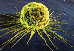 Argentina lidera la batalla en Sudamérica contra el cáncer cervical