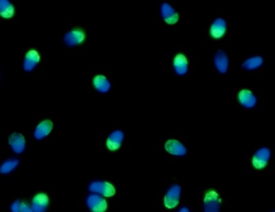 Implementan en la Argentina una novedosa técnica que selecciona los espermatozoides sanos , ya hubo más de cien nacimientos