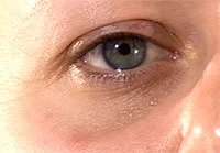 ¿Por que salen las ojeras?