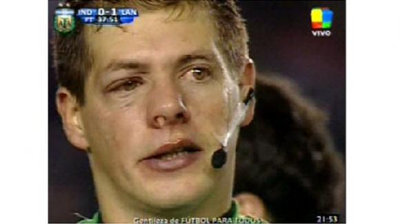 Delfino (árbitro) sufrió un tremendo pelotazo en la cara