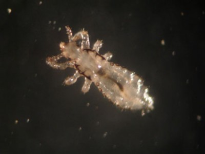 Cientificos Argentinos identifican aceites esenciales autóctonos que eliminan los piojos de forma efectiva