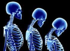 ¿Le duele algo? enderécese y se sentirá mejor