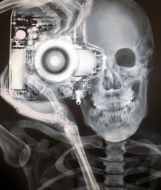 Tomando una fotografía a través de una radiografía