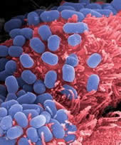 Investigadores Argentinos hallan un metodo para controlar a la bacteria causante del Síndrome Urémico Hemolítico