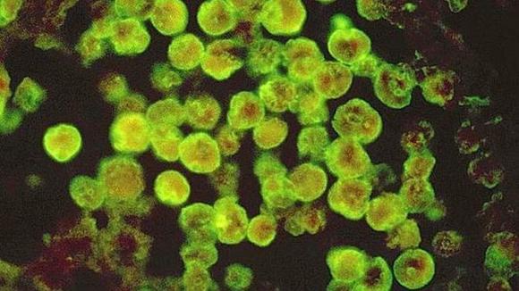 Ameba se come cerebro de seres humanos.