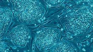 Terapia de células madre para evitar daños de infarto