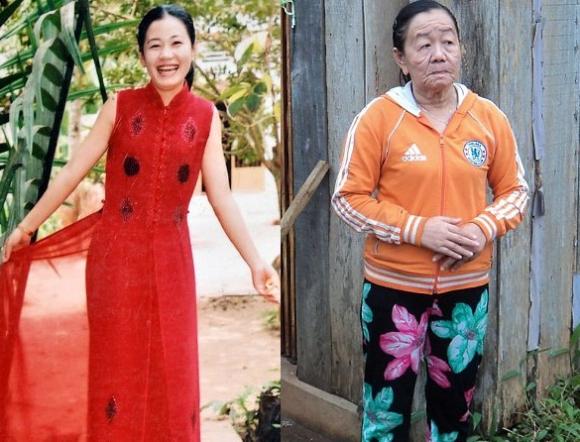 Insólito – Mujer de 26 años parece tener 70 años