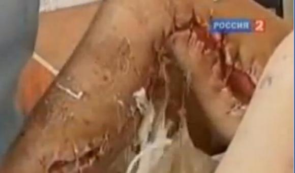 Advierten sobre una droga más letal que el paco 