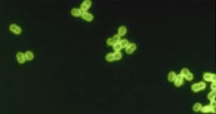 Cientificos Argentinos descubieron porqué los neumococos de Argentina son resistentes a la penicilina