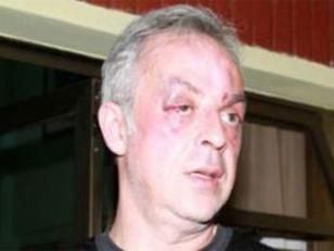 Misiones: brutal golpiza a periodista que investigó irregularidades en la provincia