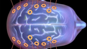 Hallan cómo comunicarse con pacientes en estado vegetativo