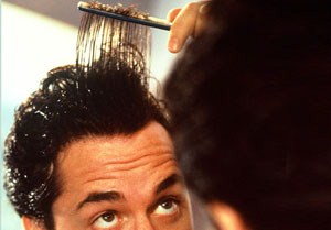 Mitos y Realidades sobre la Calvicie.