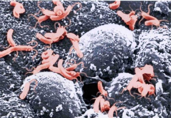 Lugares del planeta donde la vida no debería existir