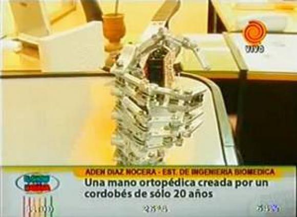 Estudiante de Ingeniería Argentino de 20 años crea una prótesis robótica comandada por señales bioeléctricas