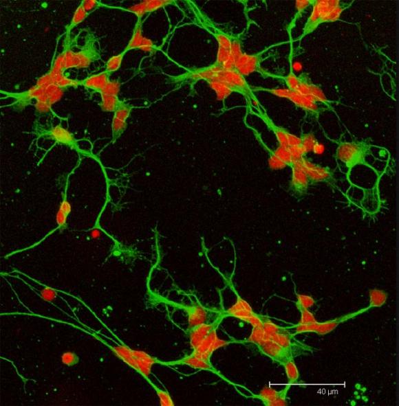 Científicos argentinos demostraron el efecto de un lípido que favorece la supervivencia y el desarrollo de los fotorreceptores de retina‏