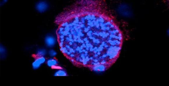 Un parásito capaz de alterar directamente la química cerebral de mamíferos