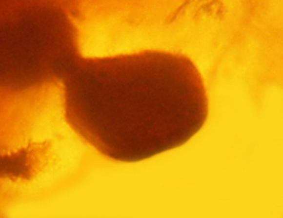 Ratifican que el paludismo (o malaria) surgió antes de que existiera el Ser Humano