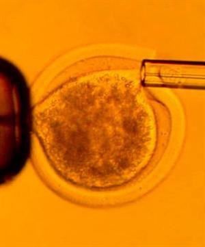 Investigadores Argentinos estudian un enigma de la salud reproductiva femenina