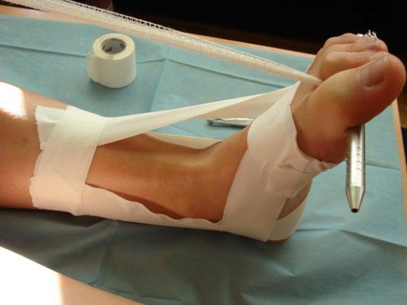 Como hacer un vendaje